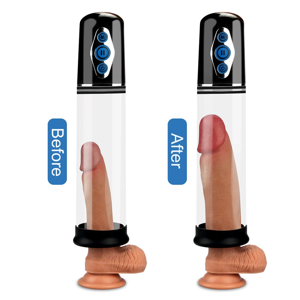 Elite otomatik emişli penis pompası seti – görsel 3